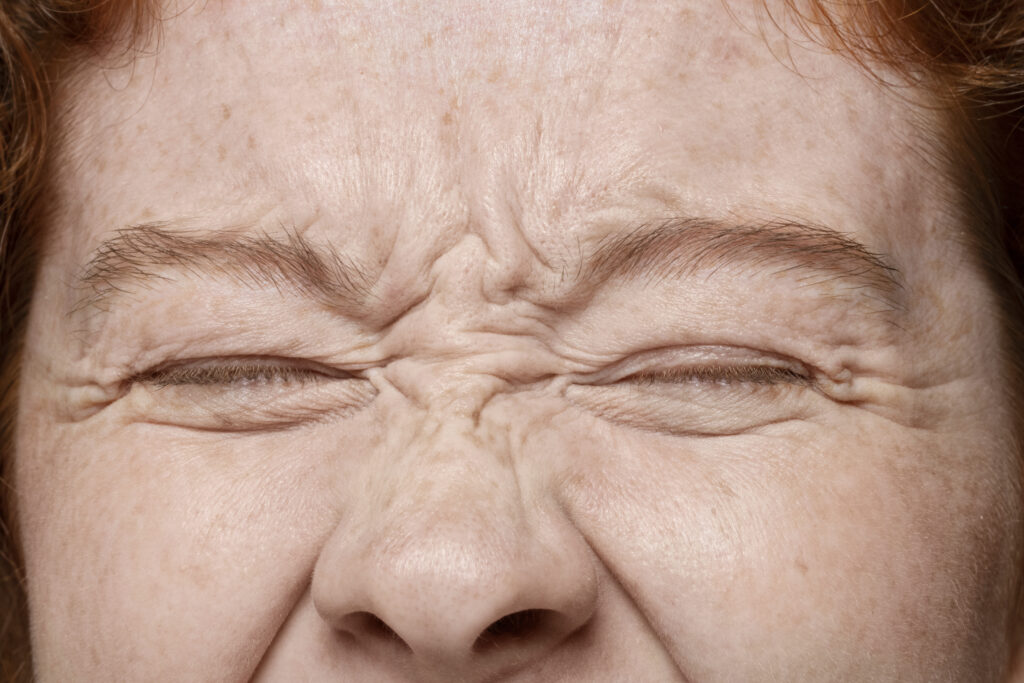 Woman frowining to show her frown and nose wrinkles