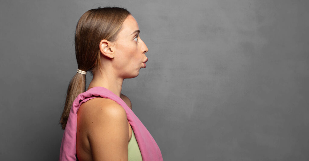 Woman with weak chin contour